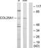 Collagen Type XXV Alpha 1 Chain antibody, TA312548, Origene, Western Blot image 