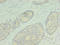 Retinol Dehydrogenase 12 antibody, LS-C371786, Lifespan Biosciences, Immunohistochemistry paraffin image 