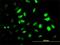 Proteasome 19S S7 antibody, H00005701-M01, Novus Biologicals, Immunocytochemistry image 
