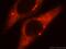SEC61A1 antibody, 15512-1-AP, Proteintech Group, Immunofluorescence image 