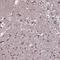  antibody, HPA063246, Atlas Antibodies, Immunohistochemistry frozen image 
