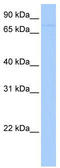 Sterile Alpha Motif Domain Containing 4A antibody, TA335588, Origene, Western Blot image 