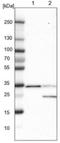 Electron Transfer Flavoprotein Subunit Alpha antibody, NBP1-84857, Novus Biologicals, Western Blot image 