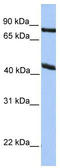 Potassium Two Pore Domain Channel Subfamily K Member 4 antibody, TA342055, Origene, Western Blot image 