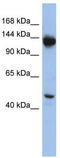 Nardilysin Convertase antibody, TA344218, Origene, Western Blot image 