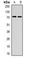 Methyltransferase Like 3 antibody, orb341486, Biorbyt, Western Blot image 