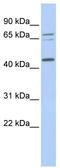 Queuine TRNA-Ribosyltransferase Catalytic Subunit 1 antibody, TA346845, Origene, Western Blot image 