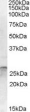 OTU Deubiquitinase, Ubiquitin Aldehyde Binding 2 antibody, MBS422049, MyBioSource, Western Blot image 