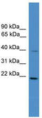 DnaJ Heat Shock Protein Family (Hsp40) Member B4 antibody, TA340147, Origene, Western Blot image 
