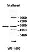Inositol Polyphosphate-5-Phosphatase K antibody, orb77985, Biorbyt, Western Blot image 