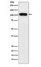 ATPase Sarcoplasmic/Endoplasmic Reticulum Ca2+ Transporting 1 antibody, M04657-2, Boster Biological Technology, Western Blot image 