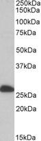 4-trimethylaminobutyraldehyde dehydrogenase antibody, 42-615, ProSci, Enzyme Linked Immunosorbent Assay image 