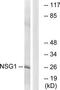 Neuronal Vesicle Trafficking Associated 1 antibody, TA315360, Origene, Western Blot image 