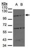 Bone Morphogenetic Protein Receptor Type 2 antibody, TA308587, Origene, Western Blot image 