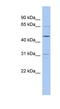 Zinc Finger Protein 641 antibody, NBP1-80150, Novus Biologicals, Western Blot image 