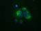 Sequestosome 1 antibody, LS-C337179, Lifespan Biosciences, Immunofluorescence image 