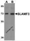 Lymphocyte Antigen 9 antibody, 6251, ProSci Inc, Western Blot image 