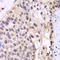 Proteasome Subunit Alpha 6 antibody, LS-C335212, Lifespan Biosciences, Immunohistochemistry paraffin image 