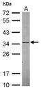 Potassium Voltage-Gated Channel Interacting Protein 2 antibody, NBP2-17026, Novus Biologicals, Western Blot image 