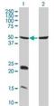 Ubiquitin Conjugating Enzyme E2 L6 antibody, H00009246-M01, Novus Biologicals, Western Blot image 