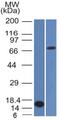 BCL6 Transcription Repressor antibody, GTX34432, GeneTex, Western Blot image 