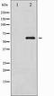 Ribosomal Protein S6 Kinase B1 antibody, TA327861, Origene, Western Blot image 
