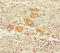 Alpha-ketoglutarate dehydrogenase antibody, A55210-100, Epigentek, Immunohistochemistry paraffin image 