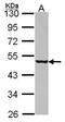 Eukaryotic initiation factor 4A-I antibody, GTX114910, GeneTex, Western Blot image 