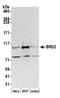 Bromodomain Containing 2 antibody, A302-582A, Bethyl Labs, Western Blot image 