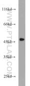 Keratin 15 antibody, 10137-1-AP, Proteintech Group, Western Blot image 