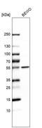 Lysophosphatidylcholine Acyltransferase 1 antibody, HPA012501, Atlas Antibodies, Western Blot image 