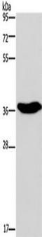ELAV Like RNA Binding Protein 3 antibody, TA351331, Origene, Western Blot image 