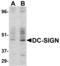CD209 antigen antibody, TA306058, Origene, Western Blot image 