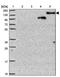 CCR4-NOT Transcription Complex Subunit 1 antibody, NBP2-31892, Novus Biologicals, Western Blot image 