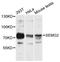 Semenogelin-2 antibody, LS-C747896, Lifespan Biosciences, Western Blot image 