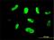 Serine/threonine-protein kinase MAK antibody, H00004117-M01, Novus Biologicals, Immunofluorescence image 