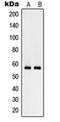 Ammonium transporter Rh type C antibody, orb215179, Biorbyt, Western Blot image 