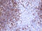 CD20 antibody, M03780-3, Boster Biological Technology, Immunohistochemistry paraffin image 