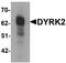 Dual specificity tyrosine-phosphorylation-regulated kinase 2 antibody, orb95655, Biorbyt, Western Blot image 