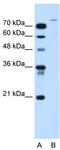 Ubiquitin Specific Peptidase 48 antibody, TA336029, Origene, Western Blot image 