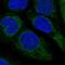 ACAT-1 antibody, NBP2-32052, Novus Biologicals, Immunocytochemistry image 