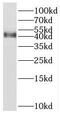 Serpin Family B Member 6 antibody, FNab07747, FineTest, Western Blot image 