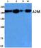 Alpha-2-Macroglobulin antibody, A01498, Boster Biological Technology, Western Blot image 
