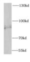 Sodium Channel Epithelial 1 Gamma Subunit antibody, FNab07649, FineTest, Western Blot image 
