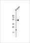 HtrA Serine Peptidase 1 antibody, 56-986, ProSci, Western Blot image 