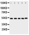 SMAD Family Member 5 antibody, PA2115, Boster Biological Technology, Western Blot image 