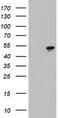 Keratin-7 antibody, CF802932, Origene, Western Blot image 