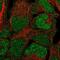 BRCA2 and CDKN1A-interacting protein antibody, PA5-65200, Invitrogen Antibodies, Immunofluorescence image 