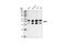 Mitogen-Activated Protein Kinase 8 antibody, 9258S, Cell Signaling Technology, Western Blot image 
