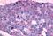 Prostacyclin receptor antibody, NLS4395, Novus Biologicals, Immunohistochemistry paraffin image 
